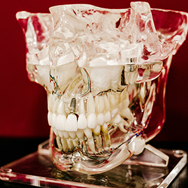 image of a dental implant model